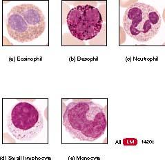 Types of White Blood Cells Which of these cells is/are phagocytic?