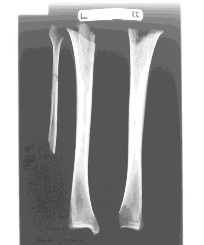 Fig. 3. Right femur, posterior.