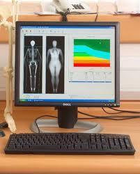 Dual-Energy X-ray Absorptiometry Gold standard measure of body composition X-ray technique Estimate body