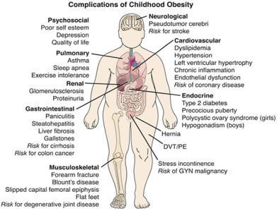 Complications of Childhood Overweight /