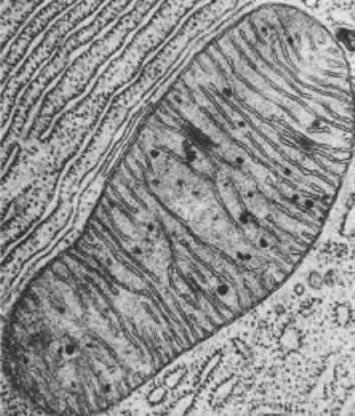 6 3 (a) The electron micrographs below show organelles in eukaryote