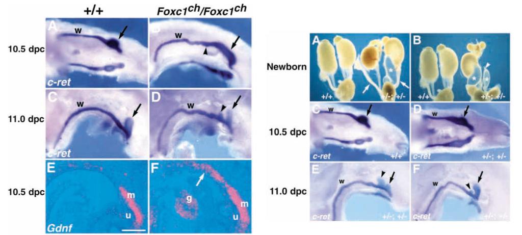 The Foxc1 and Foxc2 genes limit the anterior domain of GDNF expression This