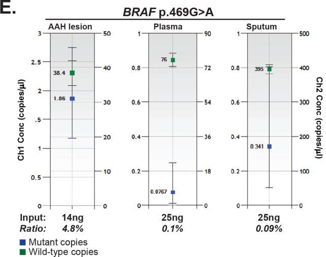 prevalence BRAF p.469g>a mutation that was identified by NGS in DNA extracted from AAH lesion, was detected by ddpcr in the associated body fluids.