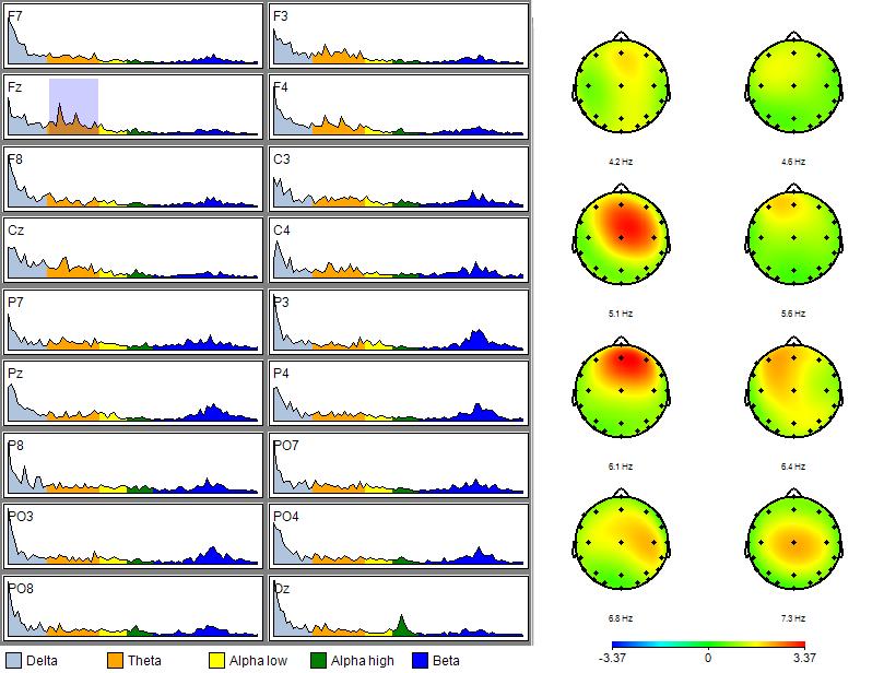 PREDICTIVE POWER OF EEG DERIVED VIGILANCE MEASURES 16 µv µv Figure 3.