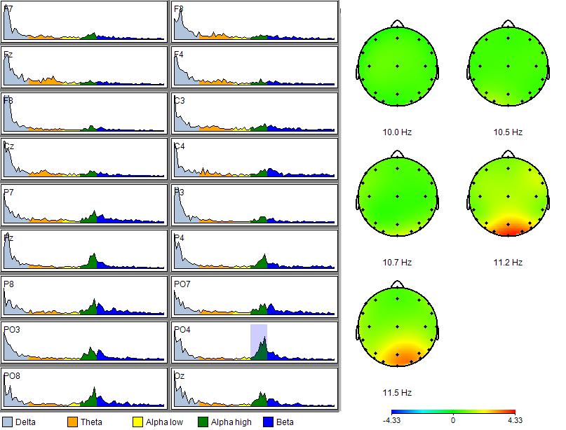 PREDICTIVE POWER OF EEG DERIVED VIGILANCE MEASURES 17 µv µv Figure 4.