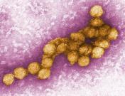 West Nile Virus (WNV) Flavivirus.