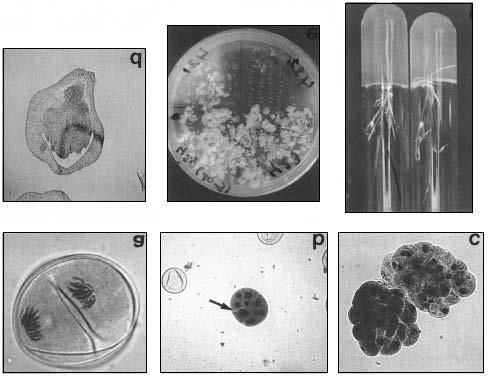 Figure: Different stages of microspore culture in barley (A) First stage of mitosis of a microspore (1250 x).