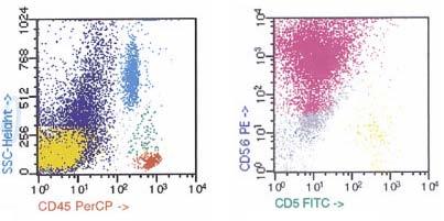 Ancillary Studies Small cell carcinoma Flow cytometry: