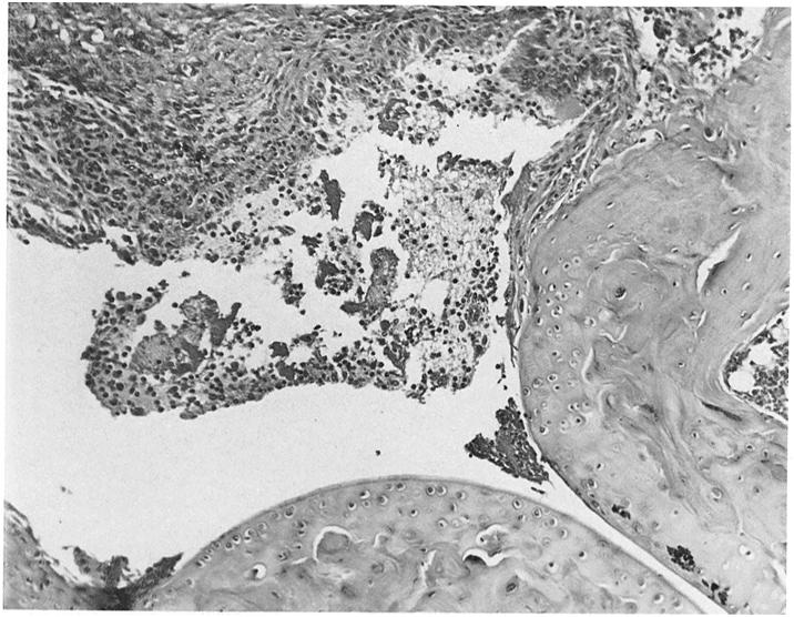 STUART AND DIXON 383 FIGURE 2. Photomicrograph of an arthritic joint from a mouse with passively transferred arthritis 72 h after injection of immunoglobulin concentrate. 50.-~ FIGURE 3.