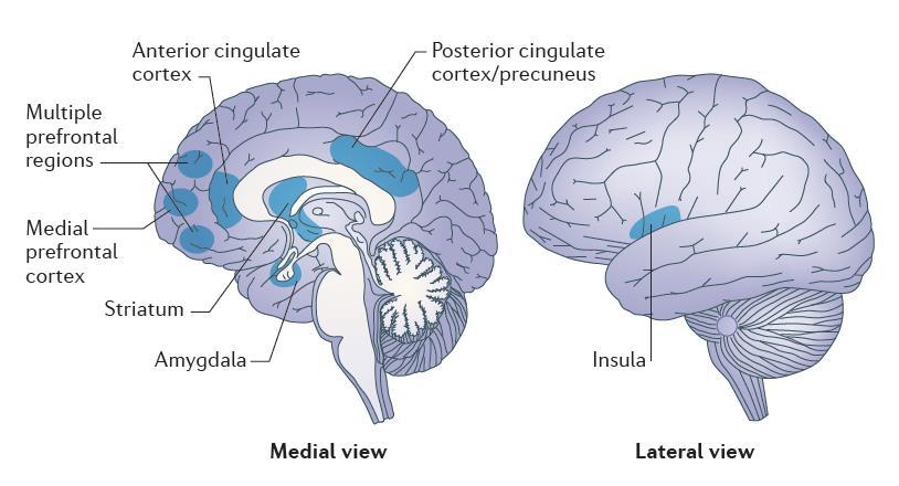 Brain regions involved in the components of mindfulness meditation attention control (the anterior cingulate cortex and the striatum) emotion regulation (multiple