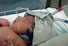or coma & hypotonia, abnormal reflexes, absent/weak suck Use of amplitude integrated EEG (aeeg) Whole Body Cooling Cooling blankets, water circulation No overhead heat source Rationale is need to get
