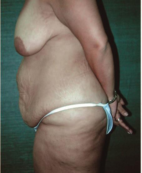 woman after a 117-lb