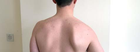 Apley s Scratch test (inferior) Shoulder