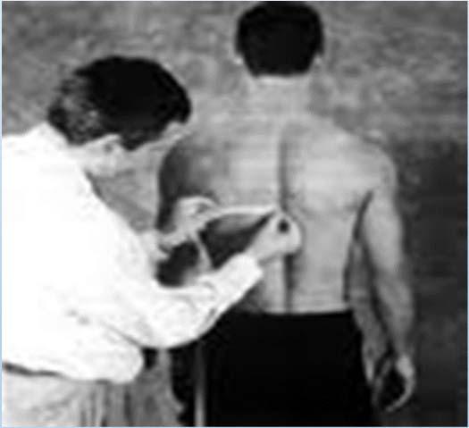Scapula Slide Test Active A test to evaluate for scapula dyskinesia Shirt off stand behind patient Measure from inferior scapula tip to spinous process (T 7!