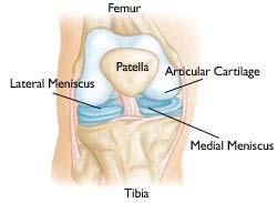 Knee Cartilage Landmarks the medial and lateral menisci: plates of fibrocartilage