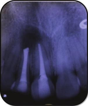 4 Case Reports in Dentistry (a) (b) (c) (d) (e) (f) (g) (h) (i) (j) (k) (l) Figure 3: (a)