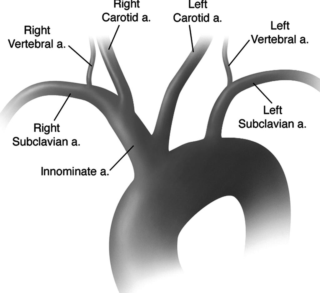 Arteries of