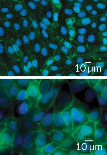Synthetic sialic acids (green) stick to the surface of cancer cells from rodents (top) and humans (bottom), giving researchers a way to test the effects of adjusting sugar levels on immune cell