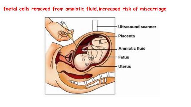 The woman is already in a high risk category, over 35 years of age Risks Amniocentesis carries a slightly increased risk of miscarriage CVS has a much higher risk of miscarriage Amniocentesis is