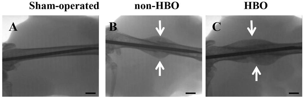 Effects of HBO on fracture healing Kawada S,