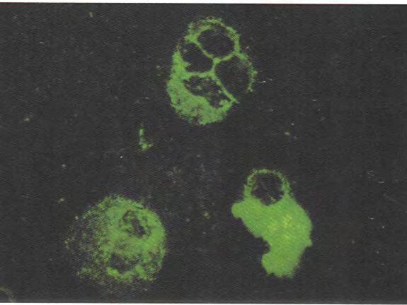 Immunofluorescent staining Cell scrape, smear fix in cold acetone rabbit