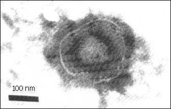 Virus Structure Enveloped, slightly pleomorphic Spherical 120 200 nm in