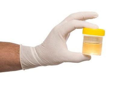 Catheter Specimen of Urine (CSU) Obtaining a CSU when there is no clinical evidence of CAUTI may lead to a false positive result, unnecessary