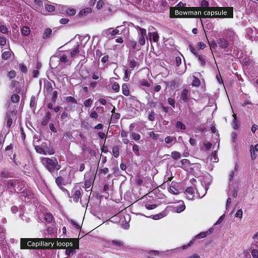 Renal corpuscle Glomerulus + Bowman s capsule Glomerular endothelium Fenestrated capillary endothelium Layer of highly branched and interlaced podocytes Allows filtrate to pass from plasma into the