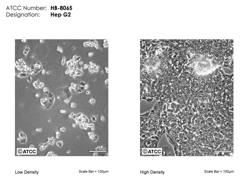 3. MATERIJALI I METODE 3.1. Kultura stanica HepG2 Kultura stanica hepatocita humanog karcinoma jetre HepG2 (engl. American Type Culture Collection, ATCC) vrsta je trajne kulture stanica.