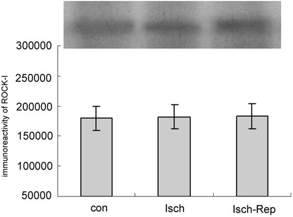 Figure 1. Western Blotting of ROCK-I (ROK β) in N2a cells. Con: control group; Isch: ischemia group; Isch- Rep: ischemia reperfusion group. There was no difference between the groups (P > 0.05).