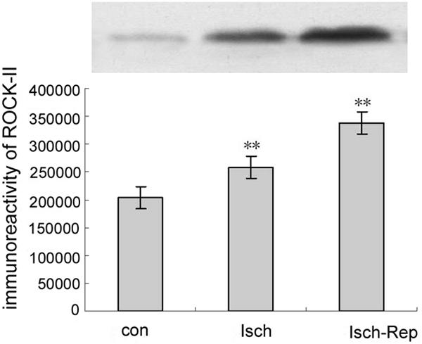Establishment of ischemia and reperfusion model in vitro and experimental groups The cell density was adjusted to be 1 10 5 /ml and cultured in 96-well plates with 100 μl in each well.