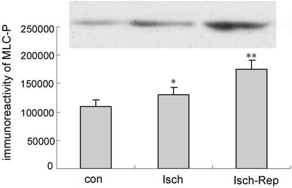 Figure 3. Western Blotting of MLC phosphorylation in N2a cells. Con: control group; Isch: ischemia group; Isch-Rep: ischemia reperfusion group.