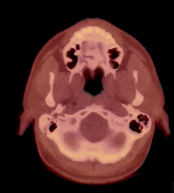 Cone Beam CT can also be