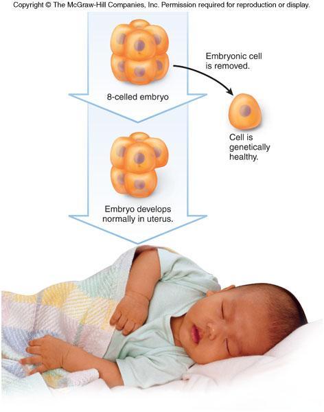 3. Embryo testing In vitro fertilization (IVF) - > Remove