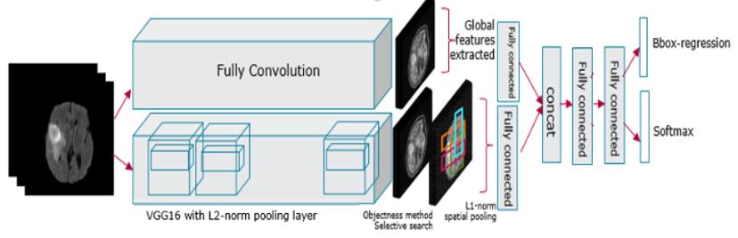 Deep Learning for Medical Image Analysis 5 to recognize high and low grad glioma tumor, ischemic stroke and it can be extendable to detection and localization on other diseases like multiple