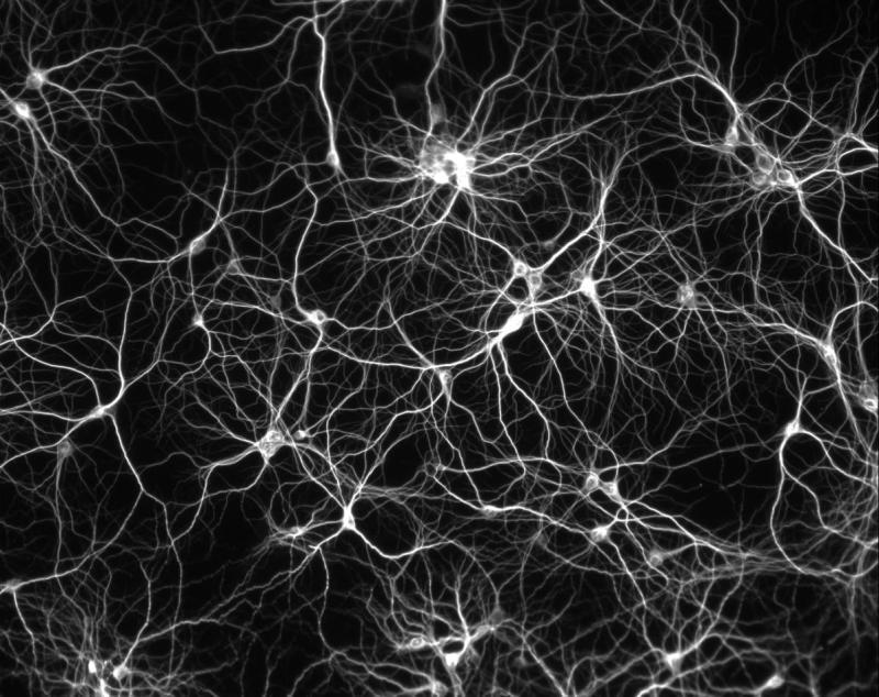 Nervous Tissue A Single Neuron from the Brain Dendrites Cell Body Axon Nerve cells, called