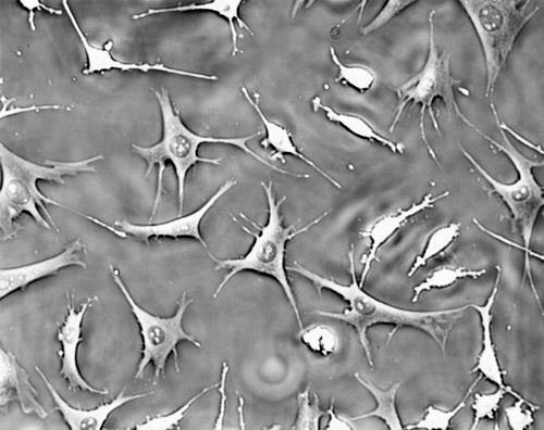 osteocyte Bone is made by two main types of cells: Osteoblasts and Osteoclasts.