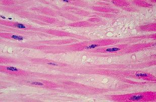 Skeletal Muscle Skeletal Muscle are 1. Attached to bones 2. Under the microscope, have alternating light and dark bands, known as striations 3. Large, have many nuclei, long and slender shaped 4.