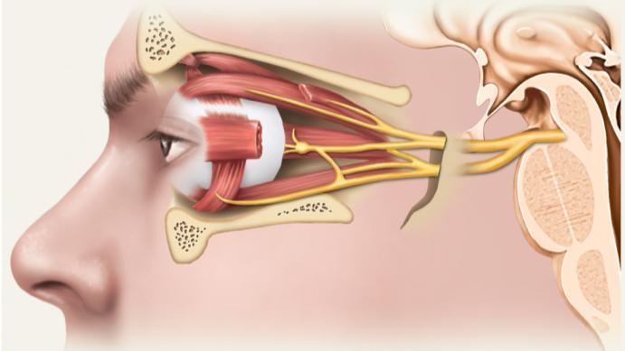 inability to move eye in certain directions IV Trochlear Nerve eye movement (superior oblique