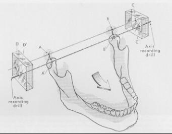 Volume 22 Jaw movements engraved in plastic 217 Fig. 9. A diagram showing the relationship of the hinge axis to a protrusive recording.