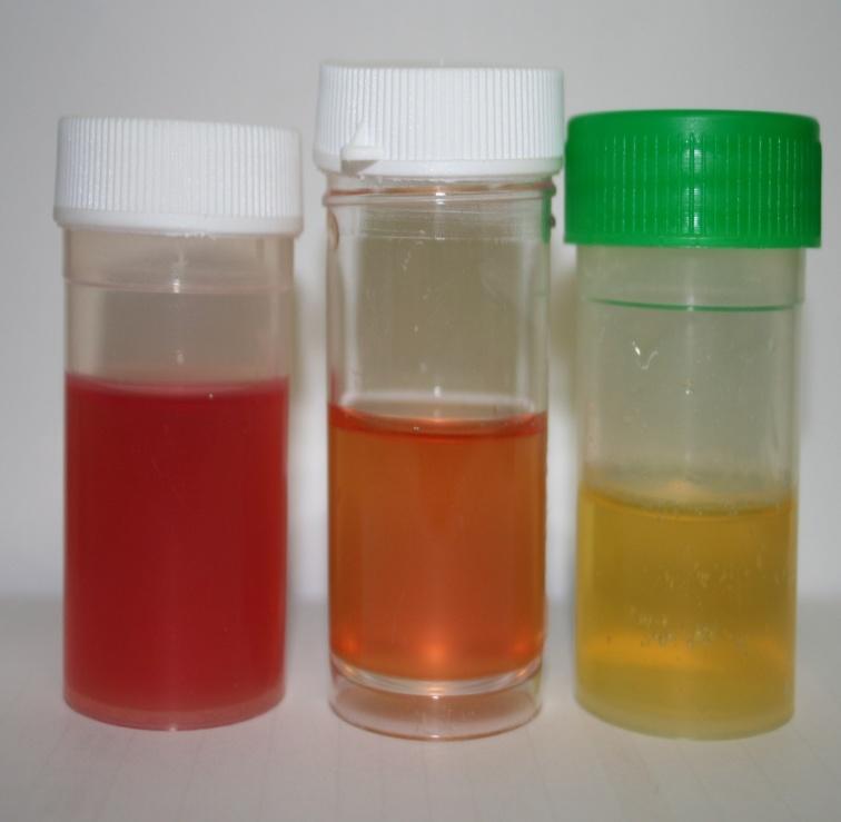 Introduction Haematuria Positive blood on urine dipstick 5 red blood cells/ microliter of urine