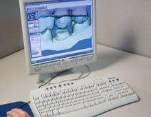 This simple step ensures that the dental laboratory has the appropriate reduction to deliver optimal aesthetics for the