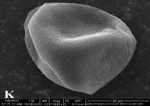 Shape and size of the pollen is