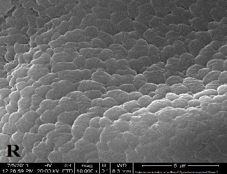Exine ornamentation of pollen is Verrucate grains with