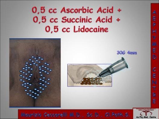 We use a bleaching solution with 0.5 ml of ascorbic acid, 0.