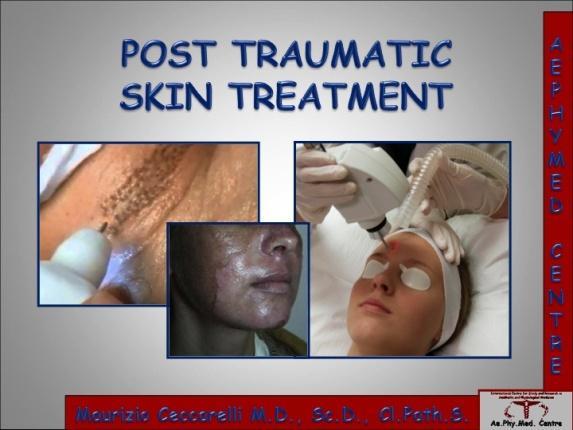 Post Traumatic Skin Treatment prevents pigmentation that can result in traumatic skin treatment.