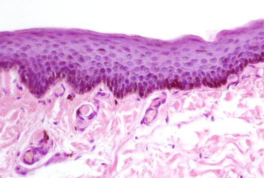 Skin structure and histology Through the dendritics branches of the melanocyte, the melanosomes containing melanin are injected into keratinocytes.