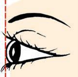 Fig 9: a ruler over the eyelids just clears corneal
