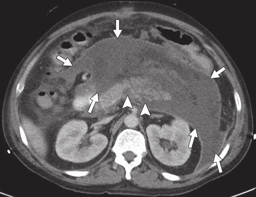 Routine CT use is, however, not warranted to confirm the diagnosis or to assess severity.
