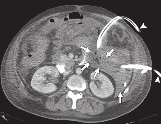 CT can be used to confirm the diagnosis when one Fig.